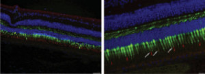 Retina di primate dopo trattamento con vettore AAV e espressione di proteina fluorescente