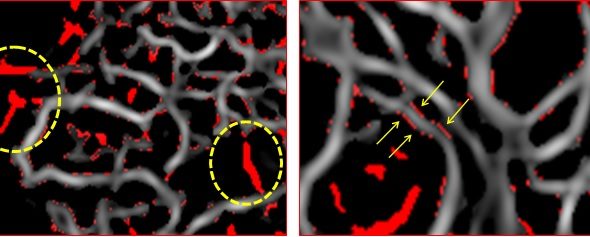 Corioretinopatia sierosa centrale: “New insights”