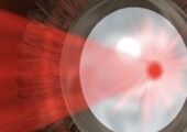 AIFA: Riconoscimento della Terapia Fotodinamica per il trattamento della corioretinopatia sierosa centrale
